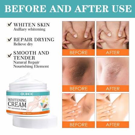 Whitening Cream for Sensitive Areas – Product